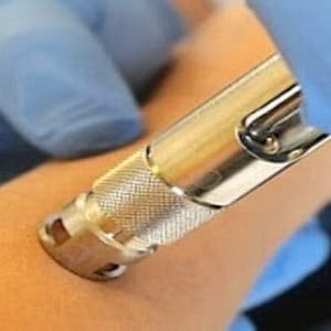 Needleless Anesthesia Device