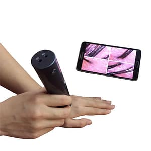 Wifi Hair Analyser Microscope