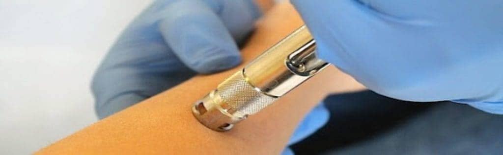 Needle-free Anesthesia