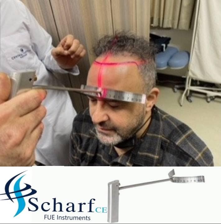 Laser Hairline Designer - Image 2